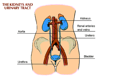 Kidney stones 1